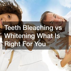teeth bleaching vs whitening